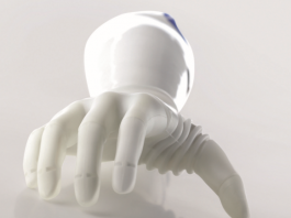 „Kein freundliches Händeschütteln“ Kampf um geeignete Unterarmprothese.